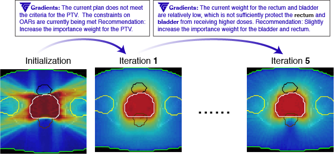 text gradients showing how to improve radiotherapy treatment plan